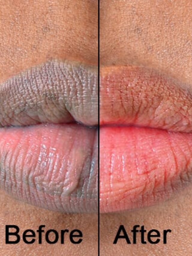 7 Natural Ways to Get Pink Lips Overnight
